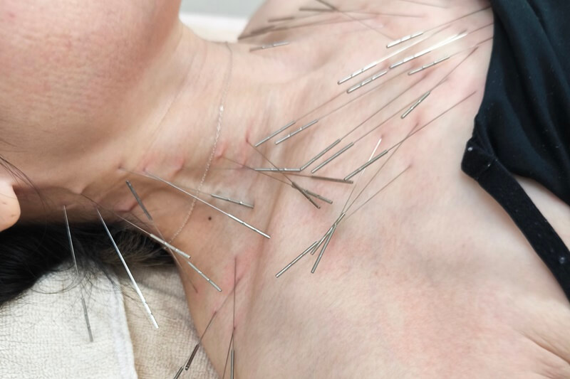 原因不明の全身の疼痛が改善した施術事例