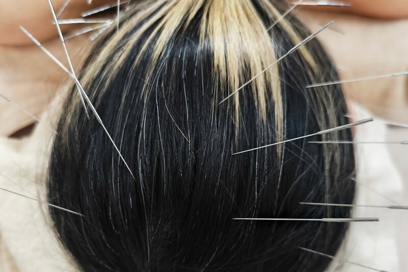 宮崎市で鍼灸による自律神経・原因不明の不調の根本治療