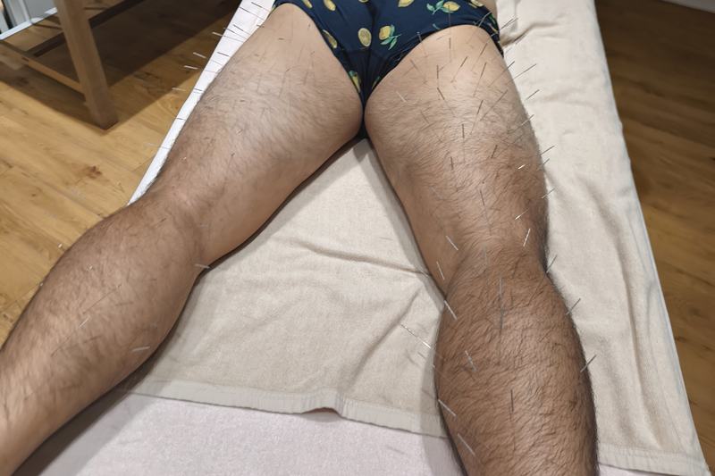 ハムストリングスと下肢への施術の様子