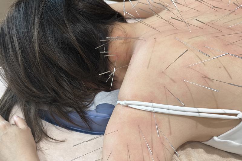 奄美での施術の様子