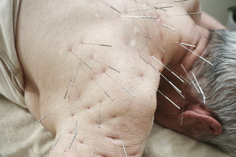 うつ伏せでの施術の様子