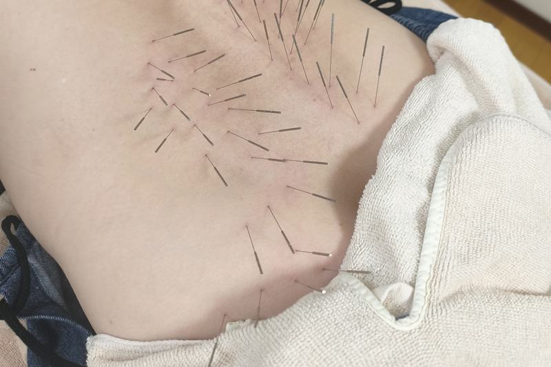 腰への施術の様子