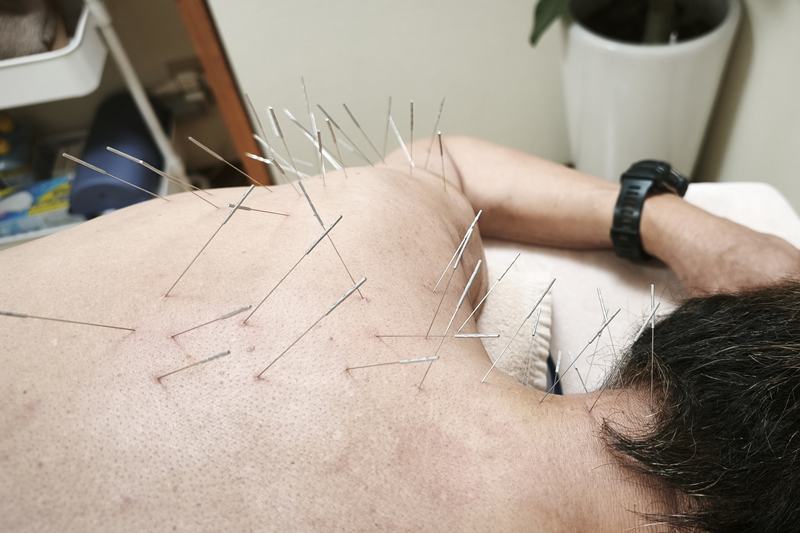 屋久島から来院された67歳男性の五十肩への鍼灸施術