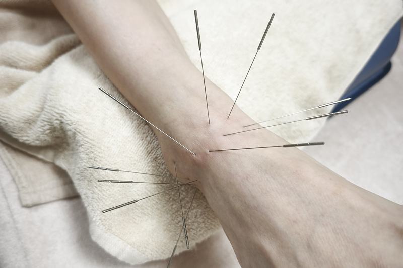 鹿児島市 捻挫 鍼灸|足首へのルート治療|きやま鍼灸治療院